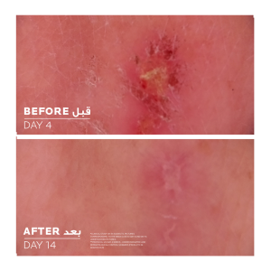 لاروش بوزيه سيكابلاست كريم مرمم ومهدئ للجلد La Roche-Posay Cicaplast Baume B5+ Ultra Repairing Soothing Balm