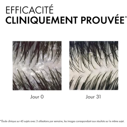 فيشي شامبو ضد القشرة ديركوس 390مل Vichy Dercos Anti-Dandruff DS Shampoo