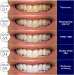 ايهلو شرائط تبييض الاسنان 7 شرائط EELHOE Teeth Whitening Strips