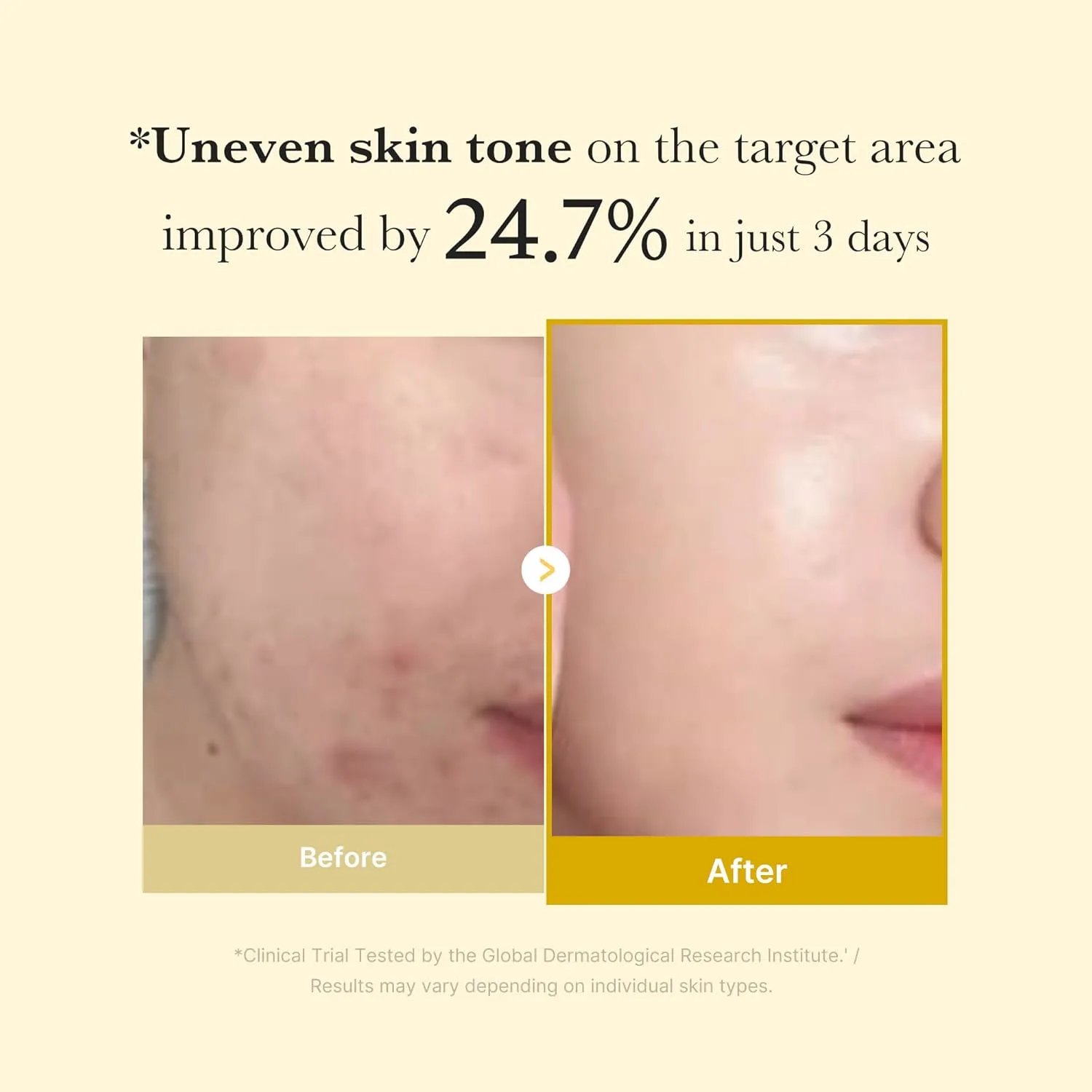 ميديكوب ماسك التفتيح الليلي بالكوجيك أسيد والكركم 75مل Medicube Kojic Acid Turmeric Night Wrapping Mask