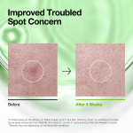 تونر أنوا Azelaic Acid 3 Cica لتهدئة الاحمرار 250مل