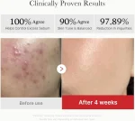 ميديكوب قطن تقشير ريد سكسينيك أسيد Medicube Red Succinic Acid Peeling Pads