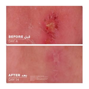 لاروش بوزيه كريم مرمم ومهدئ للجلد سيكابلاست 100 مل La Roche-Posay Cicaplast Baume B5+ Balm Cream 100ml